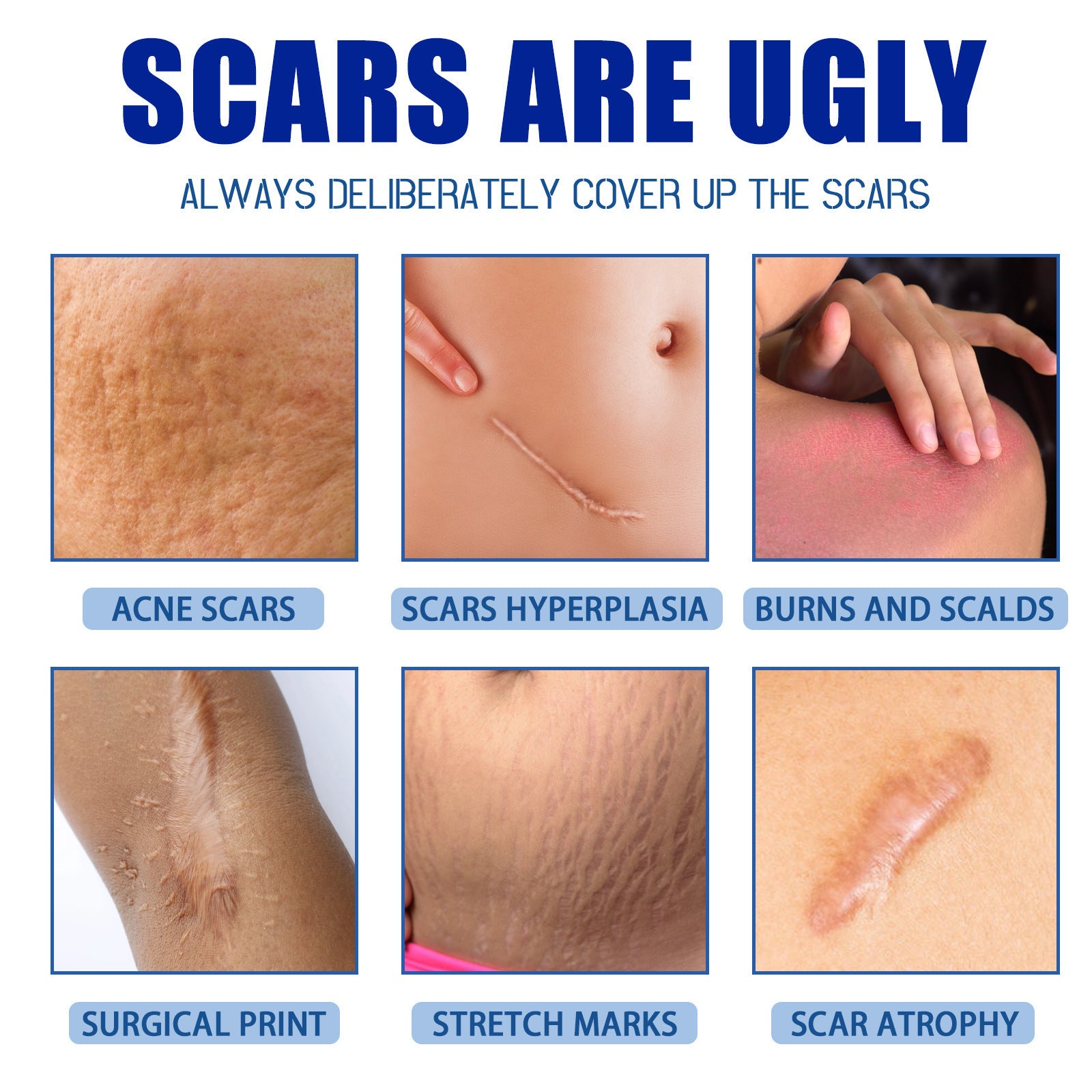 Scar Care Cream for Skin Repair