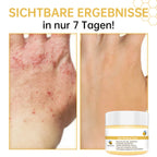 Anti-Itch Honey Cream
